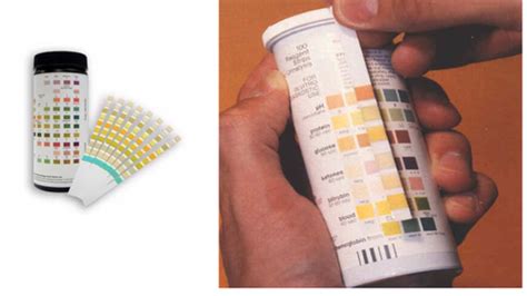 URI MLS: Urinalysis Ch. 5 (Chemical Examination) Flashcards